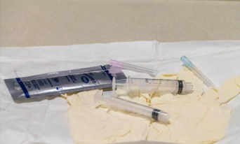 Can a Herniated Disc Cause Hip Pain? 34 Interventional Pain Management: A Modern, Non-Surgical Path to Relief