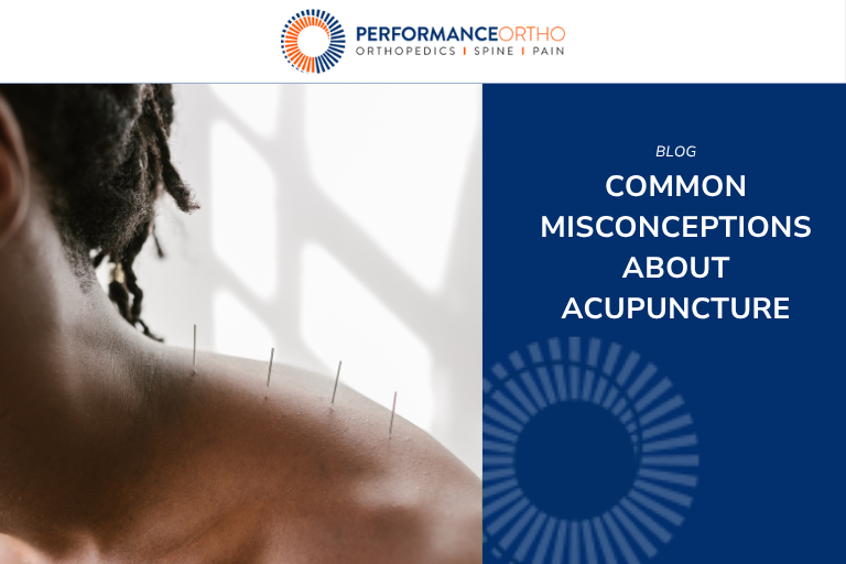 Common Misconceptions About Acupuncture