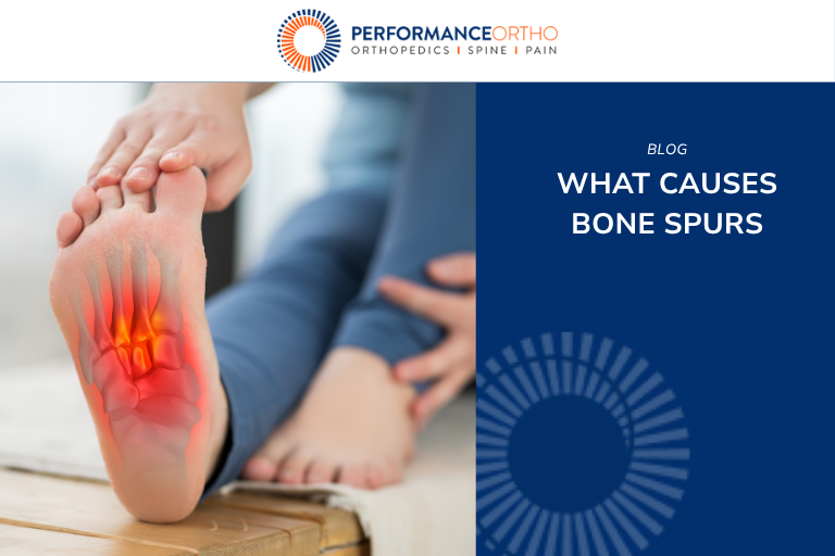 What Causes Bone Spurs