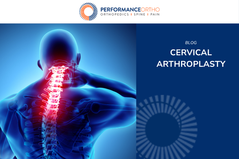 Cervical Arthroplasty