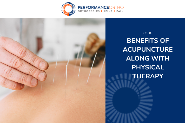 Benefits of Acupuncture Along With Physical Therapy