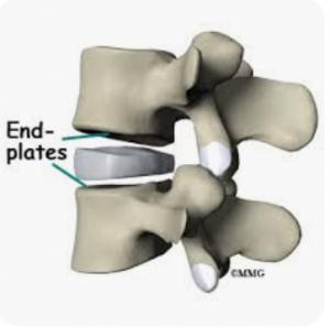 endplates