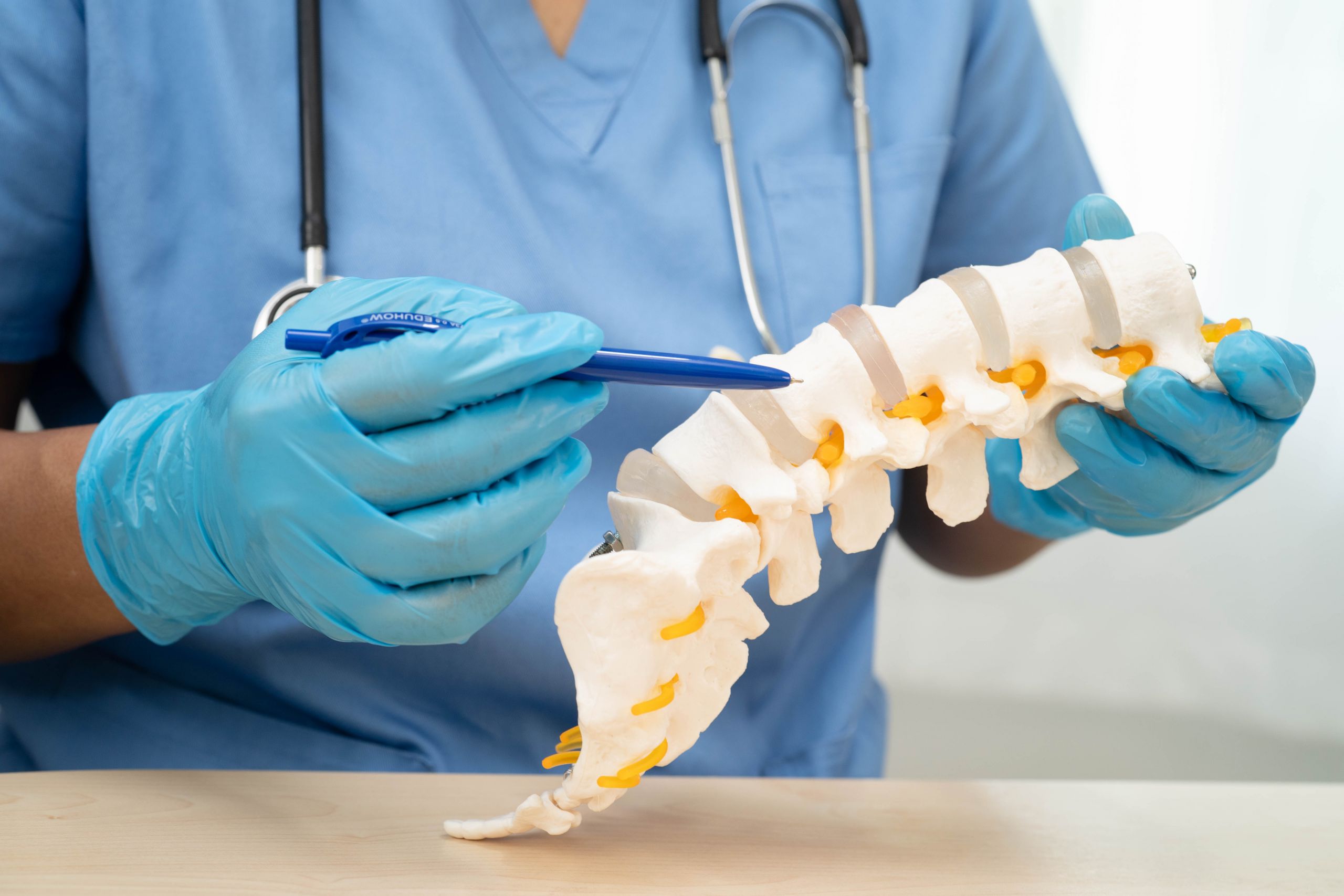 Asian doctor holding spinal nerve and bone model, Lumbar spine displaced herniated disc fragment for treatment medical in the orthopedic department.