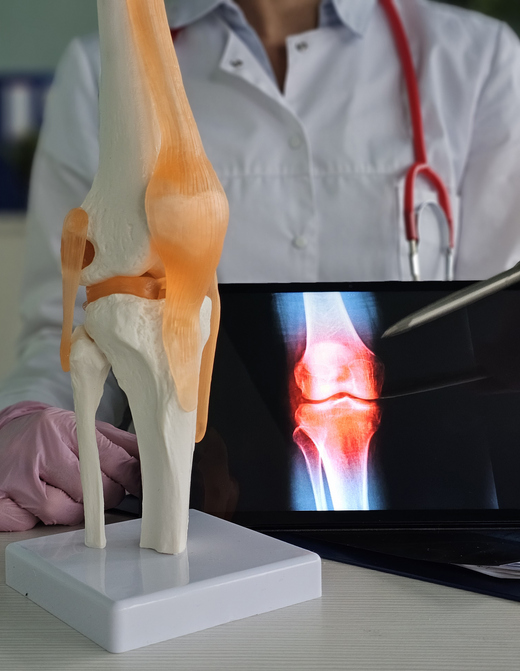 A doctor examines a model of a knee along with a digital ultrasound image of the knee joint concept