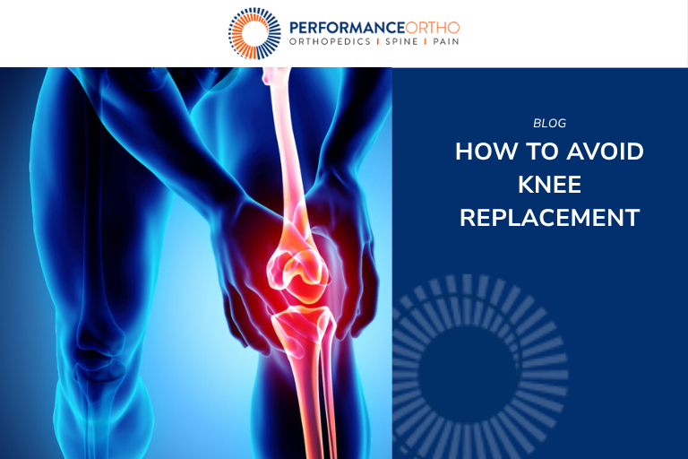 How to Avoid Knee Replacement