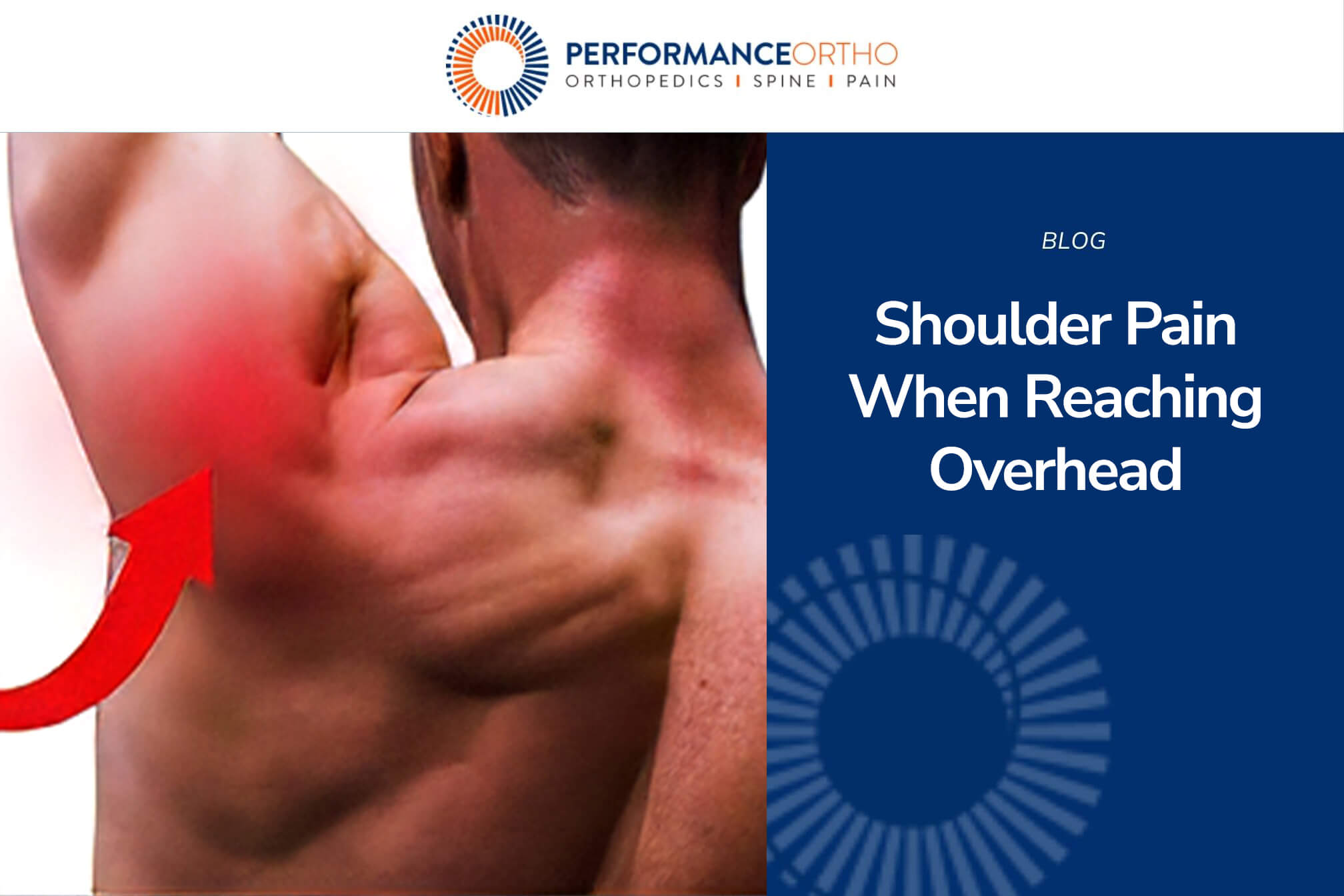 Shoulder Pain When Reaching Overhead